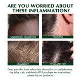 Refreshing Scalp Care Shampoo | Oil Control & Volume