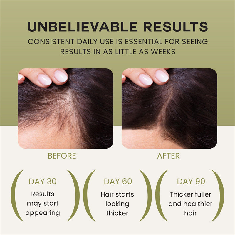 Pure Batana Hair Oil | Natural Growth & Intensive Moisturizer (120ml)